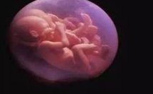 2026年拉拉在遵义医科附属医院做三代试管的成功率高吗？如何提升成功率